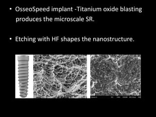 • OsseoSpeed implant -Titanium oxide blasting
produces the microscale SR.
• Etching with HF shapes the nanostructure.
 