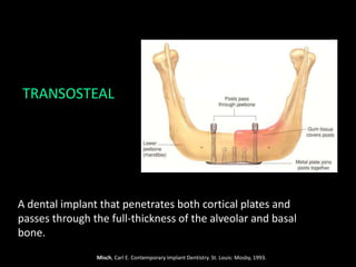 TRANSOSTEAL
A dental implant that penetrates both cortical plates and
passes through the full-thickness of the alveolar and basal
bone.
Misch, Carl E. Contemporary Implant Dentistry. St. Louis: Mosby, 1993.
 