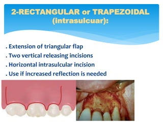 Trapezoidal Incision Endodontic Surgery | PPT