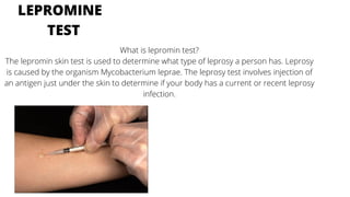 What is lepromin test?
The lepromin skin test is used to determine what type of leprosy a person has. Leprosy
is caused by the organism Mycobacterium leprae. The leprosy test involves injection of
an antigen just under the skin to determine if your body has a current or recent leprosy
infection.
LEPROMINE
TEST
 
