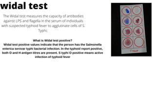 widal test
The Widal test measures the capacity of antibodies
against LPS and flagella in the serum of individuals
with suspected typhoid fever to agglutinate cells of S.
Typhi;
What is Widal test positive?
Widal test positive values indicate that the person has the Salmonella
enterica serovar typhi bacterial infection. In the typhoid report positive,
both O and H antigen titres are present. S typhi O positive means active
infection of typhoid fever
 