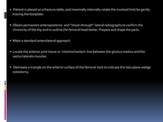  Patient is placed on a fracture table, and maximally internally rotate the involved limb by gently
moving the footplate.
 Obtain permanent anteroposterior and “shoot-through” lateral radiographs to confirm the
chronicity of the slip and to outline the femoral head better. Prepare and drape the parts.
 Make a standard anterolateral approach.
 Locate the anterior joint tissue or intertrochanteric line between the gluteus medius and the
vastus lateralis muscles.
 Delineate a triangle on the anterior surface of the femoral neck to indicate the two-plane wedge
osteotomy.
 