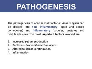 Acne Vulgaris | PPTX