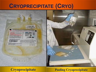 CRYOPRECIPITATE (CRYO) 
Cryoprecipitate Pooling Cryoprecipitate 
 