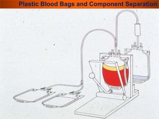 Plastic Blood Bags and Component Separation 
 