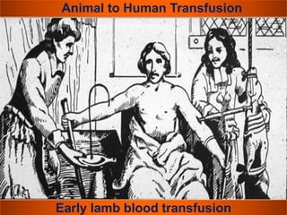 Animal to Human Transfusion 
Early lamb blood transfusion 
 