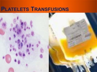 PLATELETS TRANSFUSIONS 
 