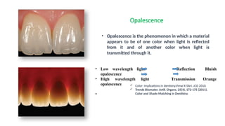 Opalescence Example seminar -color and shadematching in dentistry.pptx
