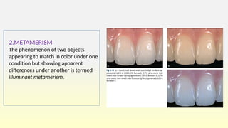 seminar -color and shadematching in dentistry.pptx