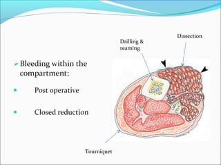Drilling &
reaming

Tourniquet

Dissection

 