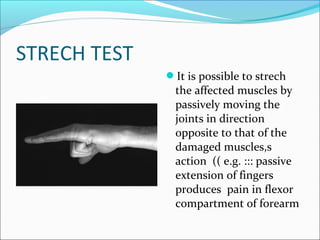 STRECH TEST
It is possible to strech

the affected muscles by
passively moving the
joints in direction
opposite to that of the
damaged muscles,s
action (( e.g. ::: passive
extension of fingers
produces pain in flexor
compartment of forearm

 