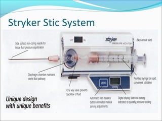 Stryker Stic System
Easy to use
Can check multiple compartments
Different areas in one compartment

 