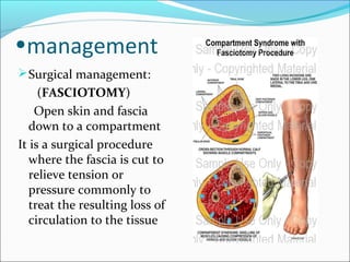 •management
 Surgical management:

(FASCIOTOMY)
Open skin and fascia
down to a compartment
It is a surgical procedure
where the fascia is cut to
relieve tension or
pressure commonly to
treat the resulting loss of
circulation to the tissue

 