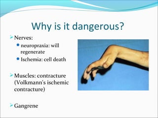Why is it dangerous?
 Nerves:
neuropraxia: will

regenerate
Ischemia: cell death

 Muscles: contracture

(Volkmann's ischemic
contracture)

 Gangrene

 
