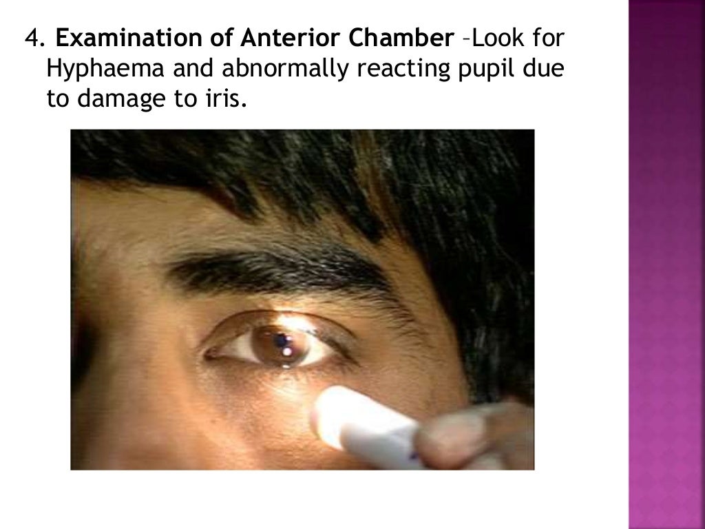 Examination of eyes