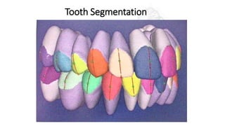 Tooth Segmentation
 