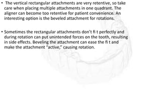 • The vertical rectangular attachments are very retentive, so take
care when placing multiple attachments in one quadrant. The
aligner can become too retentive for patient convenience. An
interesting option is the beveled attachment for rotations.
• Sometimes the rectangular attachments don’t ﬁ t perfectly and
during rotation can put unintended forces on the tooth, resulting
in side effects. Beveling the attachment can ease the ﬁ t and
make the attachment “active,” causing rotation.
 