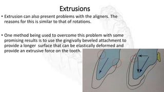 Extrusions
• Extrusion can also present problems with the aligners. The
reasons for this is similar to that of rotations.
• One method being used to overcome this problem with some
promising results is to use the gingivally beveled attachment to
provide a longer surface that can be elastically deformed and
provide an extrusive force on the tooth.
 