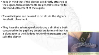 • Keep in mind that if the elastics are directly attached to
the aligner, then attachments are generally required to
prevent displacement of the aligner.
• Toe nail clippers can be used to cut slits in the aligners
for elastic placement.
• They have the advantage of producing a slit that is both
contoured to the papillary embrasure form and that has
a blunt apex to the slit does not tend to propagate and
split the aligner.
 