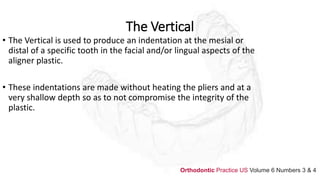 The Vertical
• The Vertical is used to produce an indentation at the mesial or
distal of a specific tooth in the facial and/or lingual aspects of the
aligner plastic.
• These indentations are made without heating the pliers and at a
very shallow depth so as to not compromise the integrity of the
plastic.
Orthodontic Practice US Volume 6 Numbers 3 & 4
 