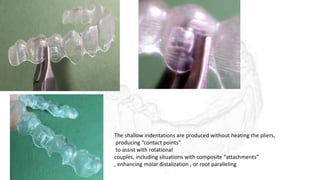 The shallow indentations are produced without heating the pliers,
producing “contact points”
to assist with rotational
couples, including situations with composite “attachments”
, enhancing molar distalization , or root paralleling
 