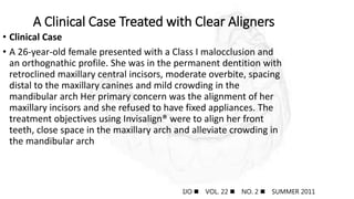 A Clinical Case Treated with Clear Aligners
• Clinical Case
• A 26-year-old female presented with a Class I malocclusion and
an orthognathic profile. She was in the permanent dentition with
retroclined maxillary central incisors, moderate overbite, spacing
distal to the maxillary canines and mild crowding in the
mandibular arch Her primary concern was the alignment of her
maxillary incisors and she refused to have fixed appliances. The
treatment objectives using Invisalign® were to align her front
teeth, close space in the maxillary arch and alleviate crowding in
the mandibular arch
IJO  VOL. 22  NO. 2  SUMMER 2011
 