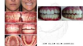 IJO  VOL. 22  NO. 2  SUMMER 2011
 