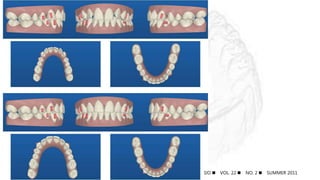 IJO  VOL. 22  NO. 2  SUMMER 2011
 