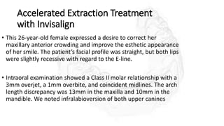 Accelerated Extraction Treatment
with Invisalign
• This 26-year-old female expressed a desire to correct her
maxillary anterior crowding and improve the esthetic appearance
of her smile. The patient’s facial profile was straight, but both lips
were slightly recessive with regard to the E-line.
• Intraoral examination showed a Class II molar relationship with a
3mm overjet, a 1mm overbite, and coincident midlines. The arch
length discrepancy was 13mm in the maxilla and 10mm in the
mandible. We noted infralabioversion of both upper canines
 