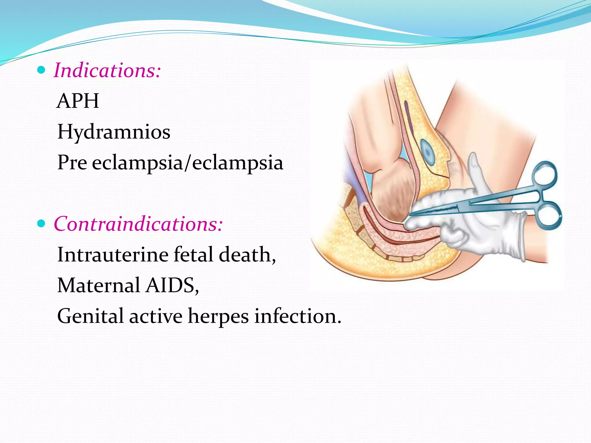  Indications:
APH
Hydramnios
Pre eclampsia/eclampsia
 Contraindications:
Intrauterine fetal death,
Maternal AIDS,
Genital active herpes infection.
 