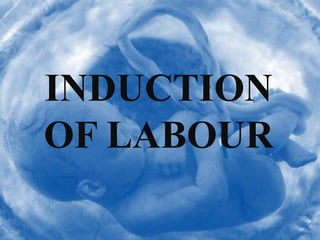 INDUCTION
OF LABOUR
 