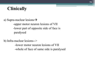 Clinically
a) Supra-nuclear lesions
-upper motor neuron lesions of VII
-lower part of opposite side of face is
paralysed
b) Infra-nuclear lesions-->
-lower motor neuron lesions of VII
-whole of face of same side is paralysed
76
 