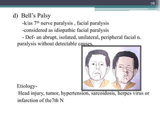 d) Bell’s Palsy
-k/as 7th nerve paralysis , facial paralysis
-considered as idiopathic facial paralysis
- Def- an abrupt, isolated, unilateral, peripheral facial n.
paralysis without detectable causes.
Etiology-
Head injury, tumor, hypertension, sarcoidosis, herpes virus or
infarction of the7th N
78
 
