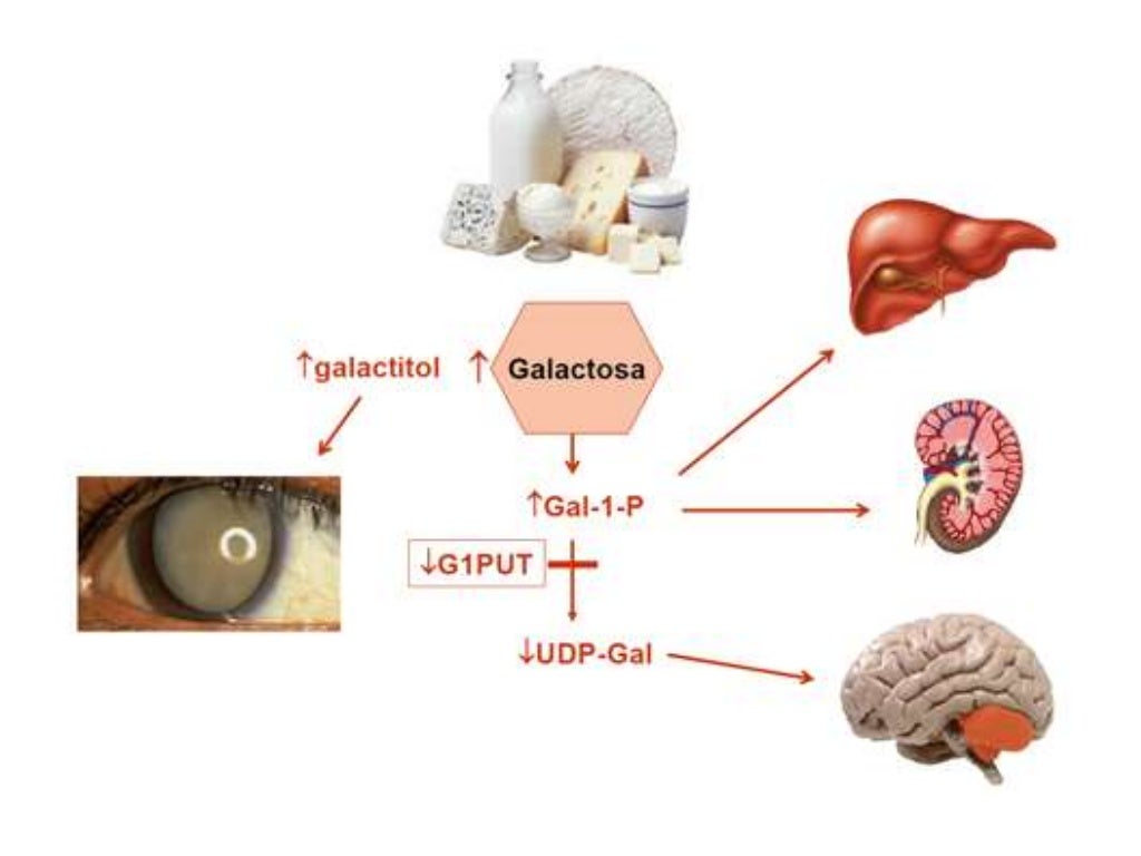 Neonatal Cholestasis