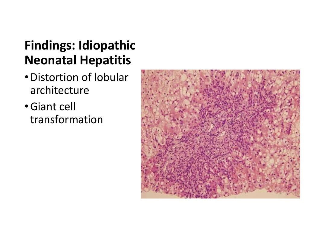 Neonatal Cholestasis