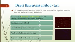Direct fluorescent antibody test
 The ideal tissue to test for rabies antigen is brain because rabies is present in nervous
tissue (and not blood like many other viruses).
Flouresecent (fluorescein isothiocyanate) labeled
antibody is incubated with rabies-suspect brain tissue.
If antigen present, it will bind.
Unbound antibody can be washed away.
Visualized under fluorescence microscope.
If rabies virus is absent there will be no staining.
15
http://www.cdc.gov/rabies/diagnosis/direct_fluorescent_antibody.html
 