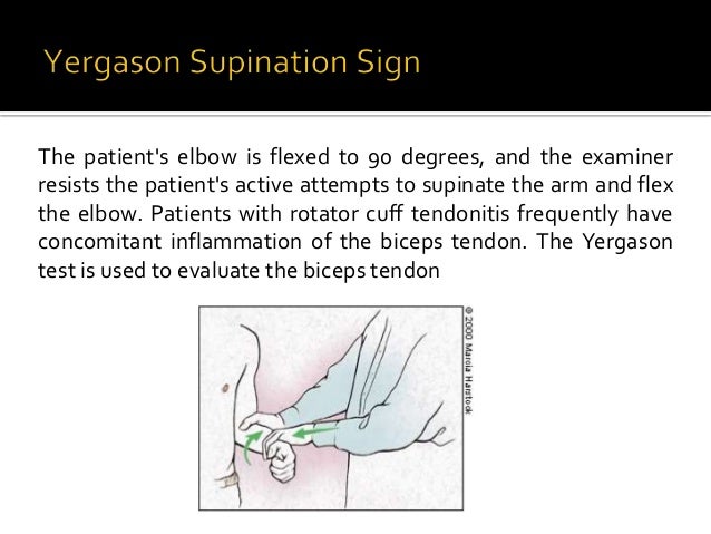 Seminar rotator cuff