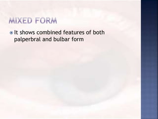  It shows combined features of both
palperbral and bulbar form
 