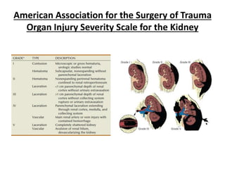 American Association for the Surgery of Trauma
Organ Injury Severity Scale for the Kidney
 