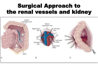 Surgical Approach to
the renal vessels and kidney
 