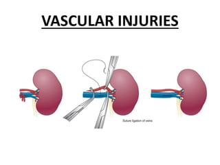 VASCULAR INJURIES
 