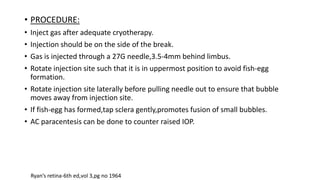 Limbus Injected Vitreous substitutes in ophthalmology | PPTX