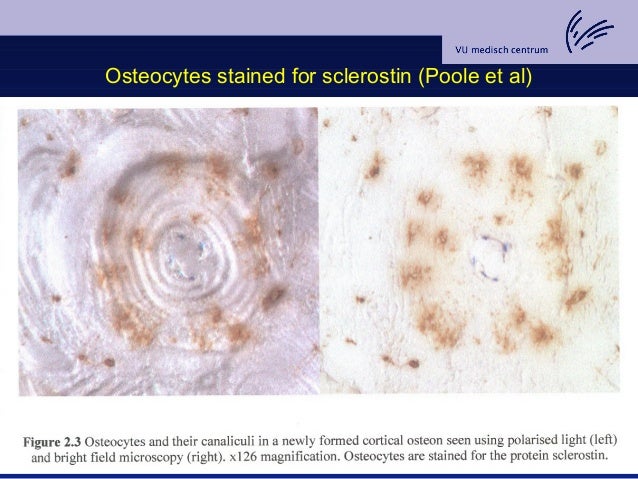 Seminar 04 03 2009 Bone Turnover In A Clinical Perspective - 