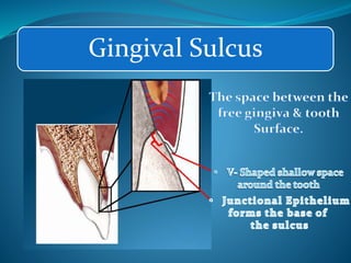 Gingival Sulcus
 