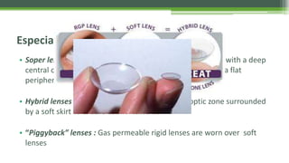 Piggyback Rgp Keratoconus - Dr Shylesh B Dabke | PPTX