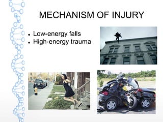 MECHANISM OF INJURY
 Low-energy falls
 High-energy trauma
 