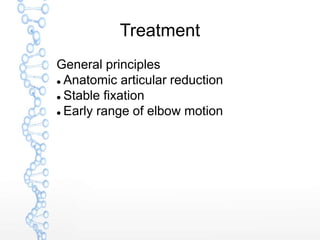 Treatment
General principles
 Anatomic articular reduction
 Stable fixation
 Early range of elbow motion
 