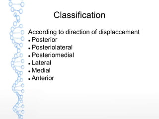 Classification
According to direction of displaccement
 Posterior
 Posteriolateral
 Posteriomedial
 Lateral
 Medial
 Anterior
 