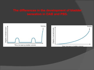The differences in the development of bladder
sensation in OAB and PBS.
 