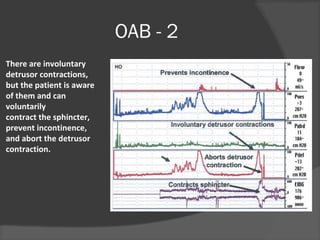OAB - 2
There are involuntary
detrusor contractions,
but the patient is aware
of them and can
voluntarily
contract the sphincter,
prevent incontinence,
and abort the detrusor
contraction.
 
